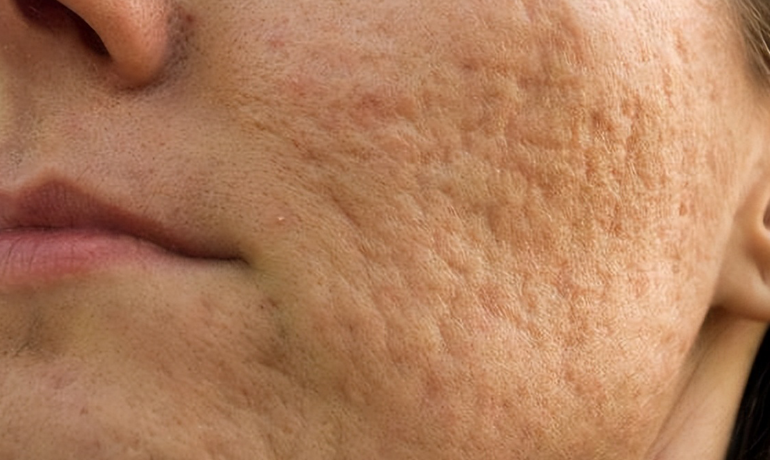 拥有娇嫩肌肤的秘诀，让你光彩照人