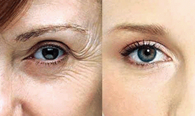 祛皱技巧与要点，恢复年轻光彩！